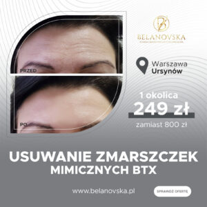 Usuwanie zmarszczek mimicznych BTX